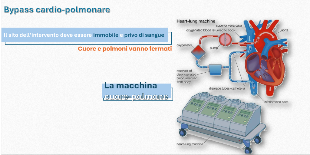 Biomedical Engineering Bypass Diagram